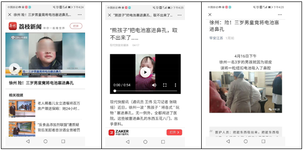 鼻孔异物-仁慈口腔科
