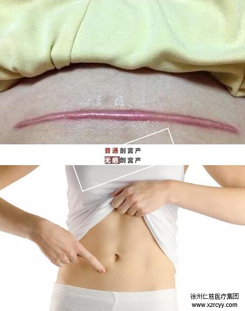 徐州仁慈医院妇产科