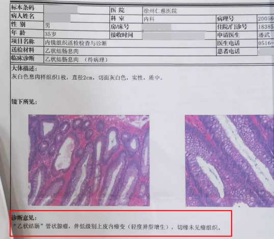 徐州仁慈医院消化内镜