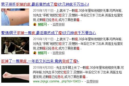 色素痣