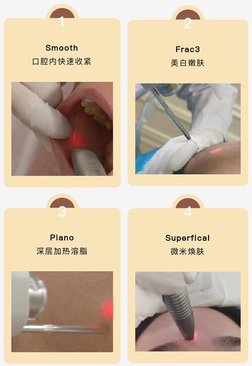 福利