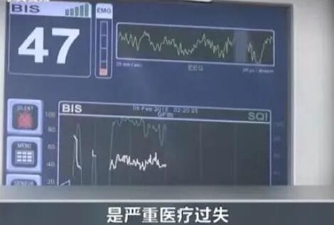 韩国整容