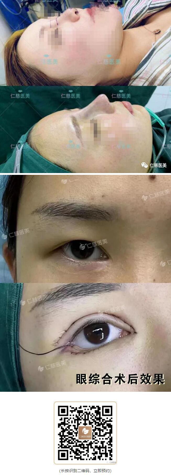 刘凯
