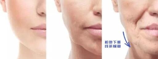 下颌线