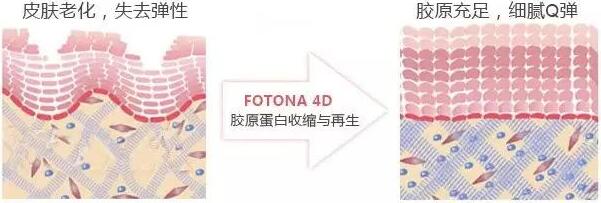 下颌线