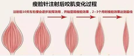 包子脸