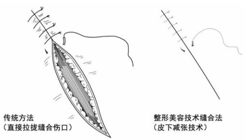 炸伤
