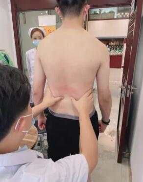 中医正骨专家
