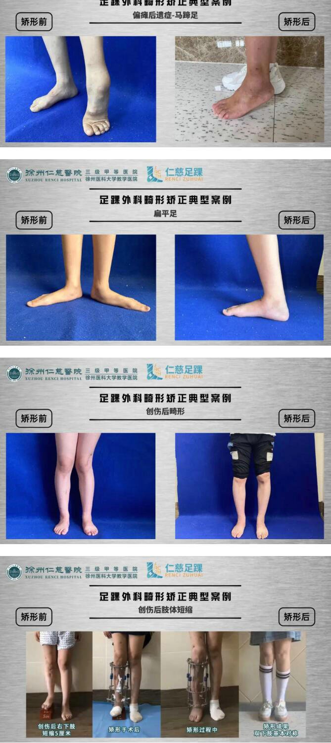 徐州仁慈医院