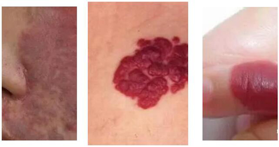 <a href='http://www.xzrcym.com/' target='_blank'><u>仁慈医美</u></a>