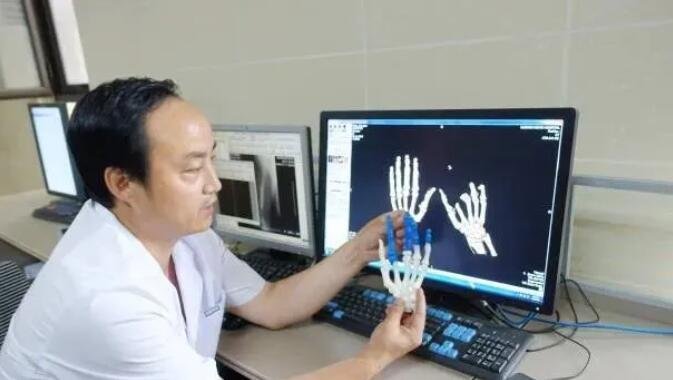 徐州仁慈医院石荣剑教授团队省内率先使用3D打印技术辅助手指再造